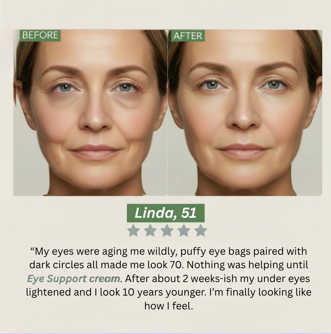 Eye Support Gel-Cream