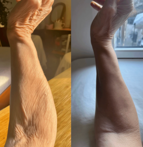 Margaret S. – Age 60