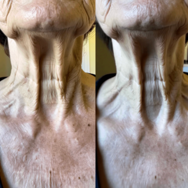 Patricia K. – Age 68